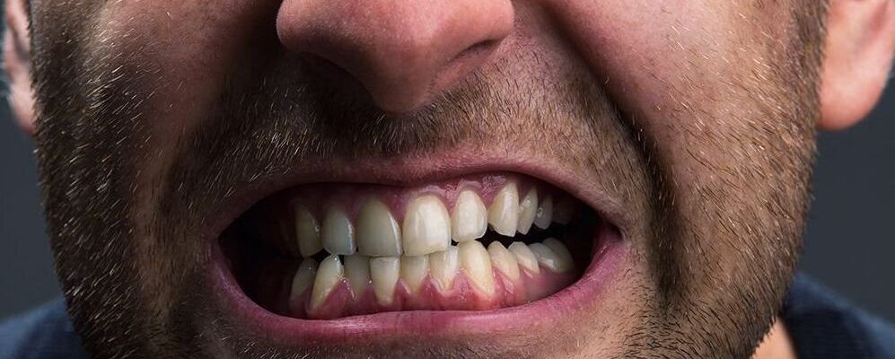 Problemas habituales de dientes en los deportistas profesionales